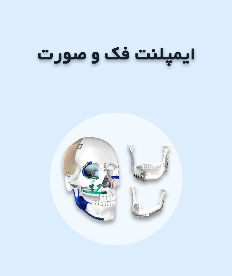 ایمپلنت های فک و صورت
